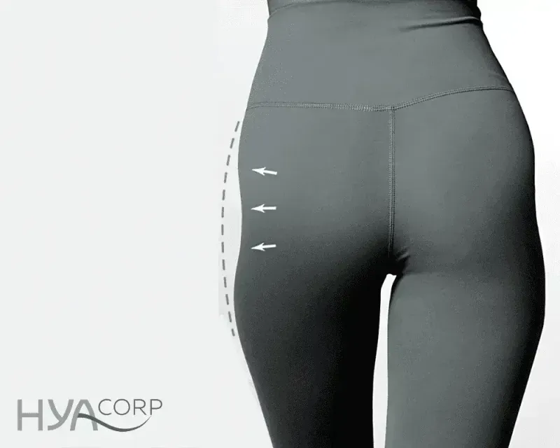 Read more about the article How to Get Rid of Hip Dips? A Conversation with Plastic Surgeon