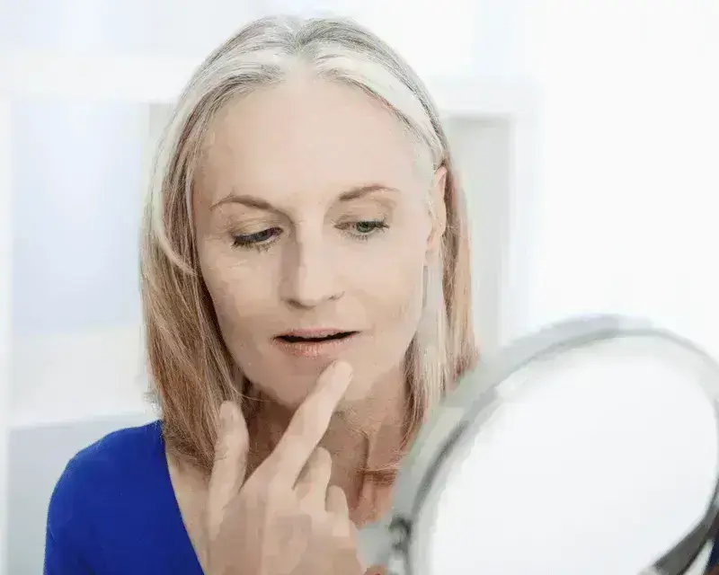 Read more about the article How to get rid of Marionette Lines