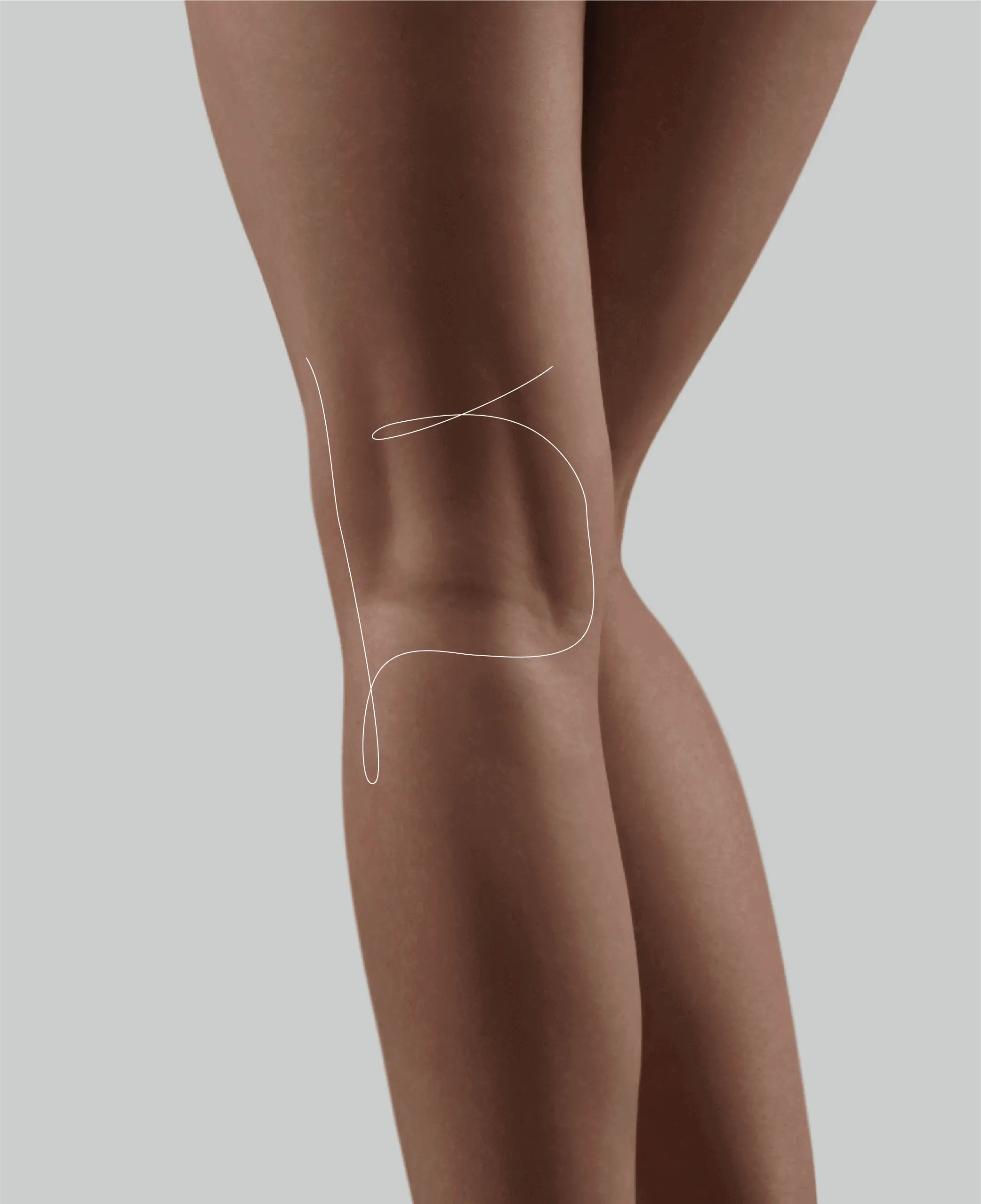 Correction of Concave Deformities Restore volume and correct deformities