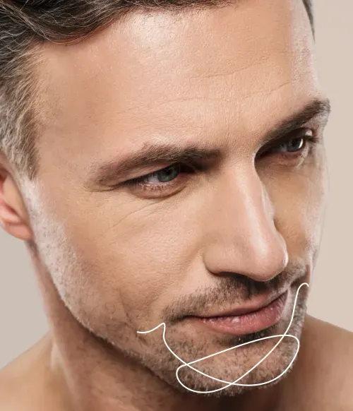 Chin Shaping Restore Volume and Create a Stronger-Looking Chin or Correct Chin Clefts