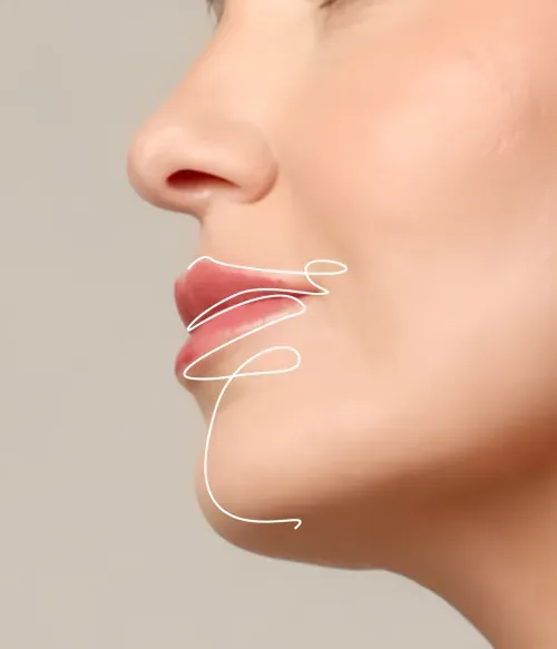 Lips Augmentation Volumize the Lips
